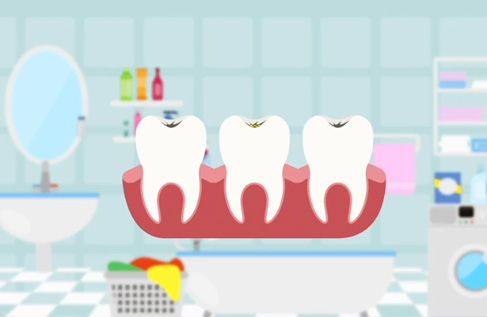 窝沟封闭“家长知道的那些事